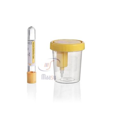 Envase de muestra de orina plástico estéril 40ml con la boca en el casquillo
